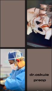 قبل و بعد جراحی تعویض مفصل لگن