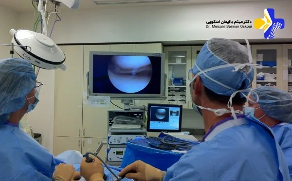 مزایای جراحی آرتروسکوپی زانو