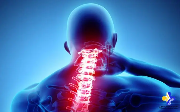 بهترین روش درمان آرتروز گردن 