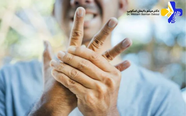 برای درمان التهاب انگشت دست، چه زمانی باید به دکتر مراجعه کنیم؟