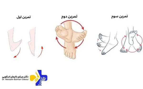 انواع ورزش برای آرتروز مچ پا